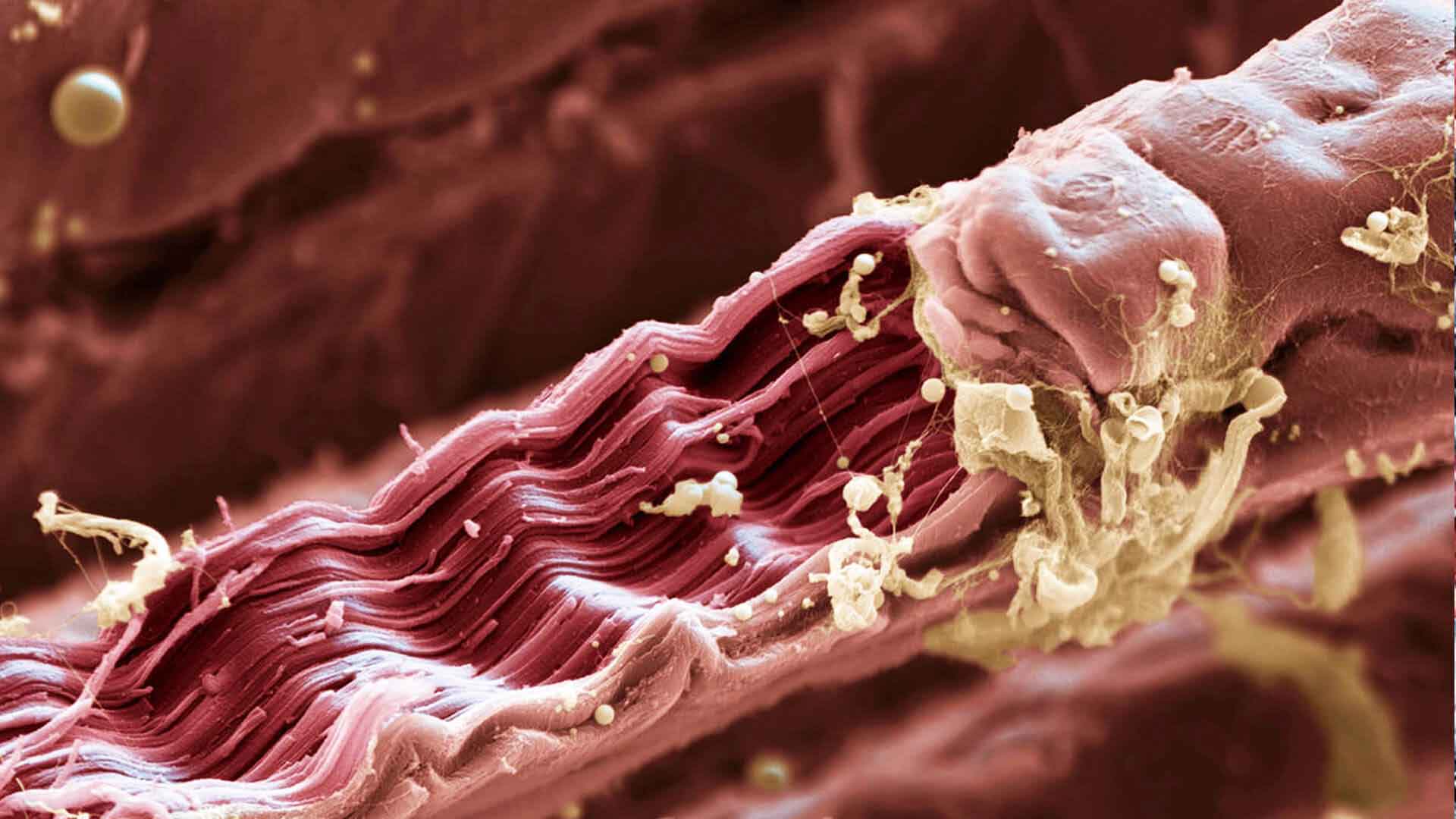 Фото мышечной ткани под микроскопом